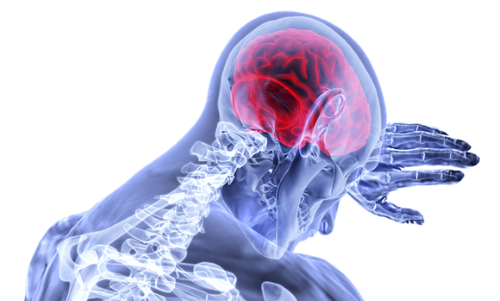 CBD prokázalo řadu pozitivních účinků i při léčbě migrén; zdroj: pixabay.com